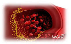 پیشگیری از چربی خون بالا